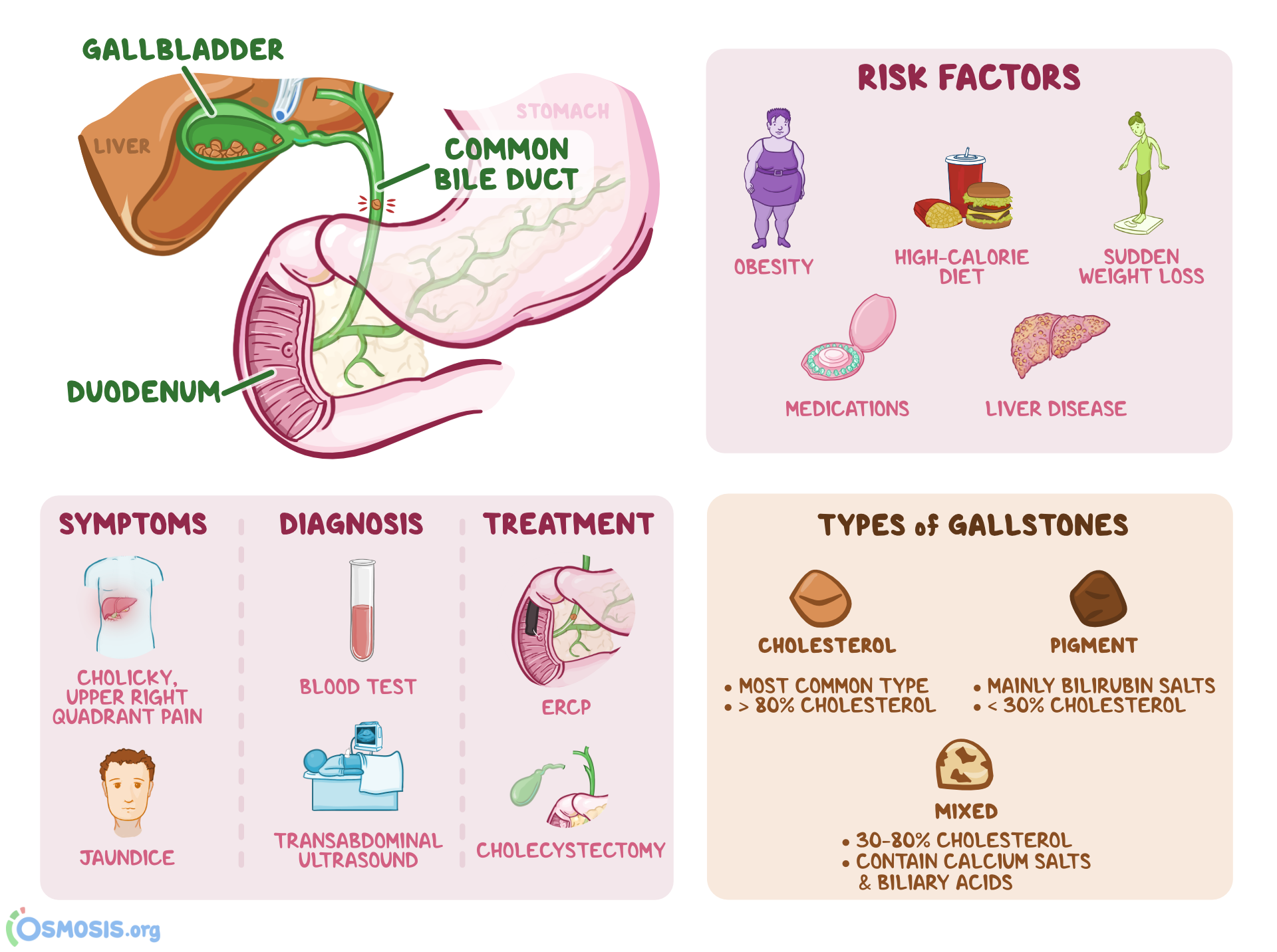 What Are Common Gallbladder Problems Symptoms Causes Diagnosis Treatment And Prevention