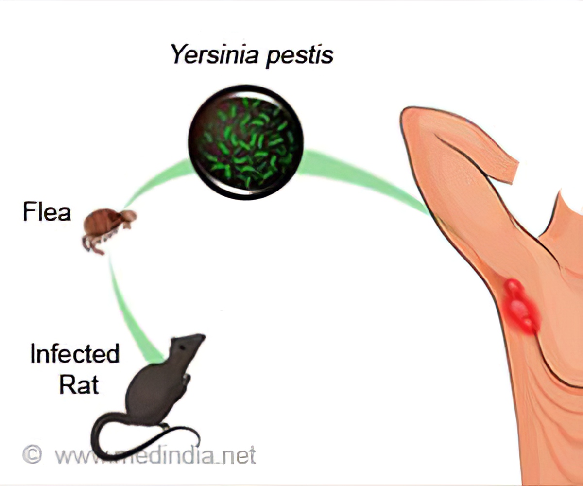 What Is Bubonic Plague Symptoms Causes Diagnosis Treatment And Prevention Health Advice 6637